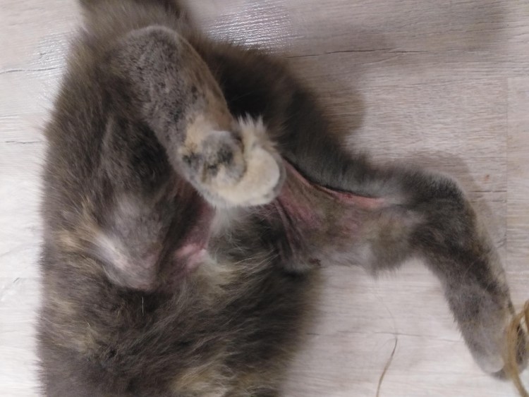 Стригущий лишай (дерматофитоз