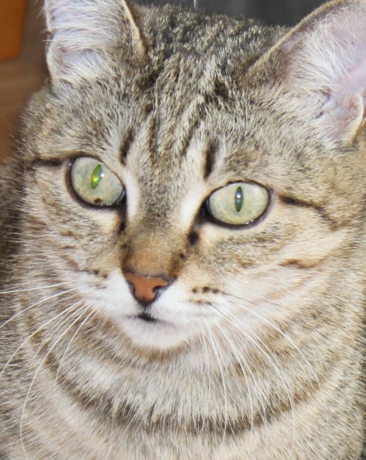 Диффузная меланома Радужки