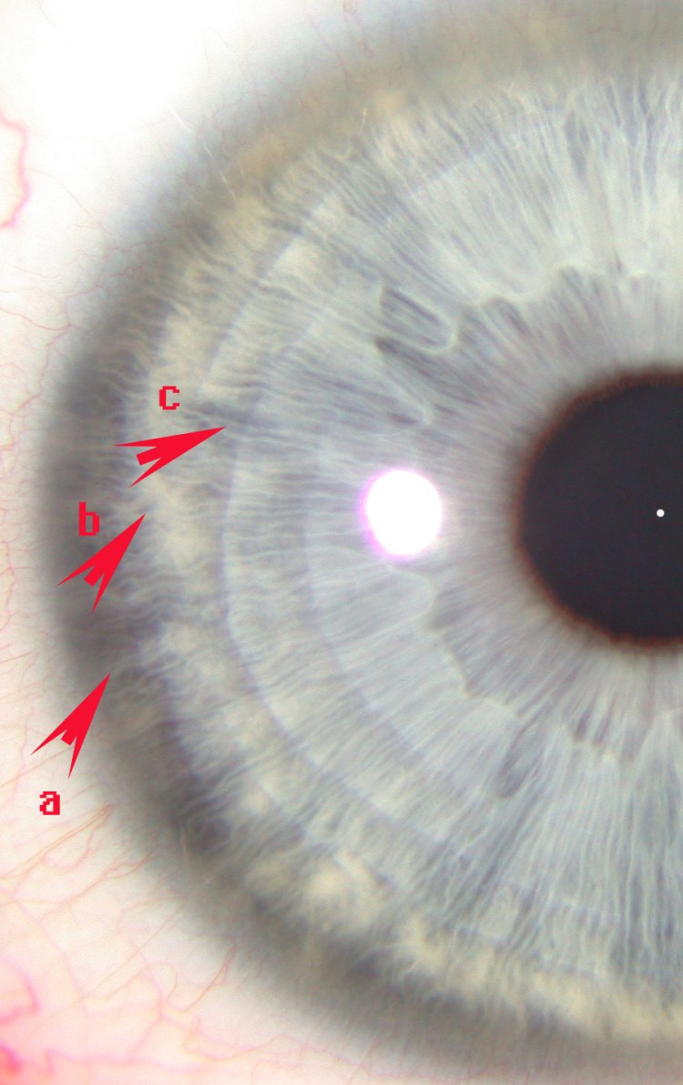 Человеческий кошачий глаз