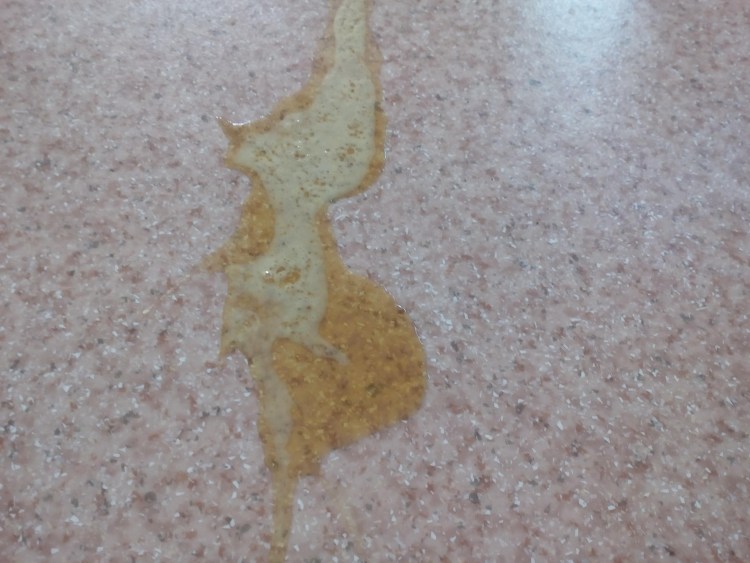 Тошнит желтой жидкостью