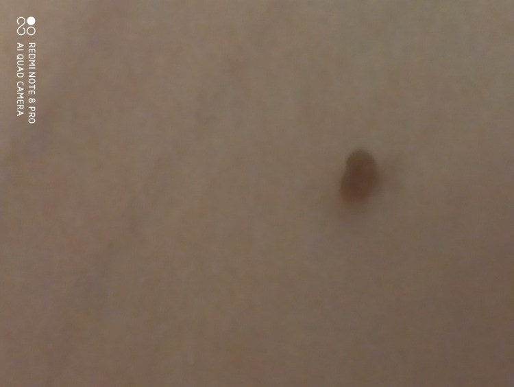 Рыжий кот с родинками на носу