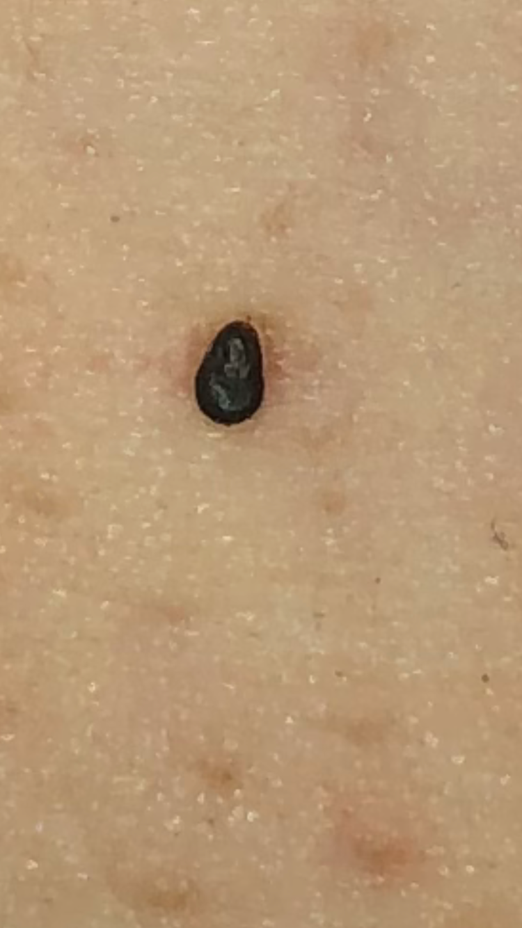 Начальная стадия лишая у котов