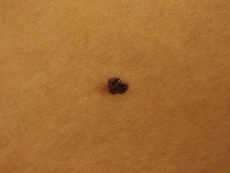 Болячки на голове у котенка