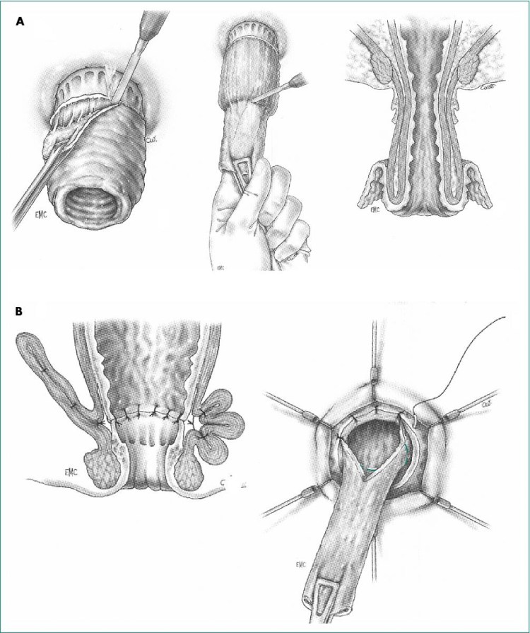 Кошка лапка Царапка