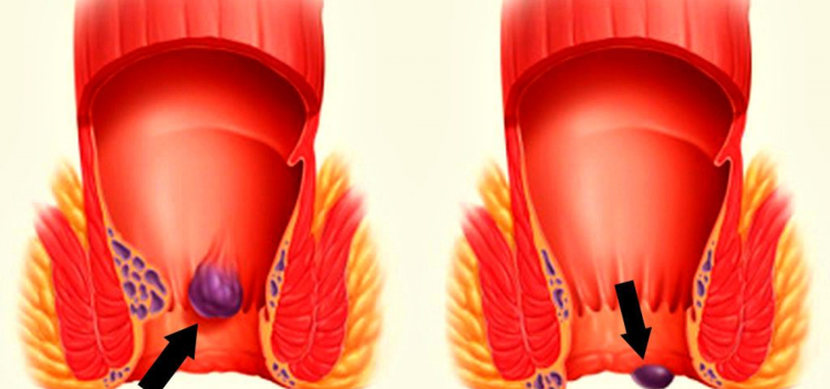 Хвостик из попы