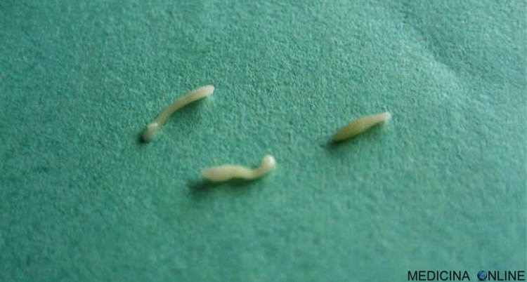 Гельминты острицы аскариды