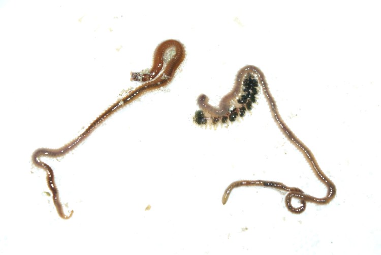 Аскаридоз, анкилостомидоз, некатороз