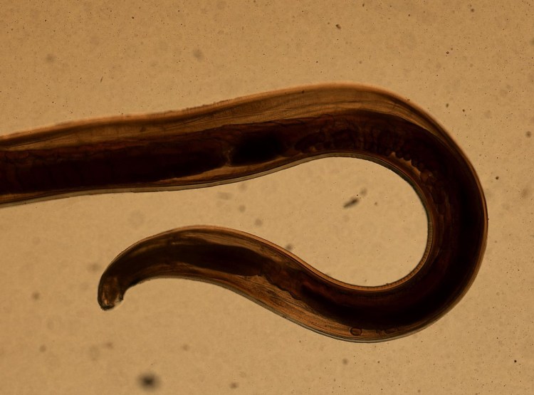 Черные червячки острицы