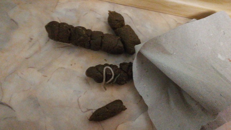 Яйца глистов энтеробиоз на туалетной