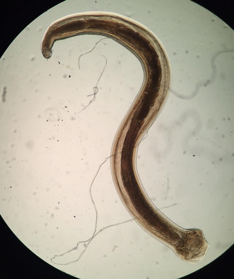 Острицы на туалетной бумаге