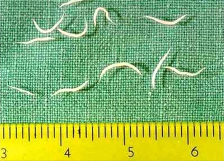 Личинки глистов аскариды