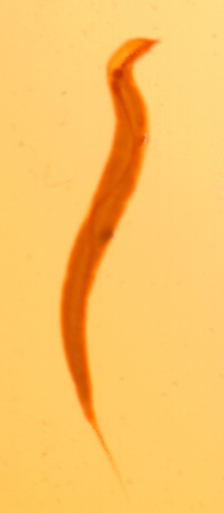 Токсокароз возбудитель Toxocara canis