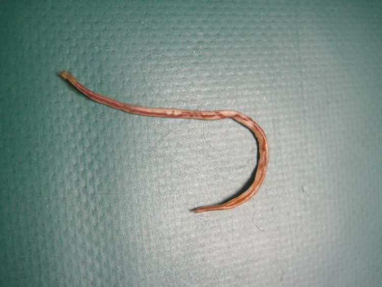 Дирофиляриоз сердечные глисты