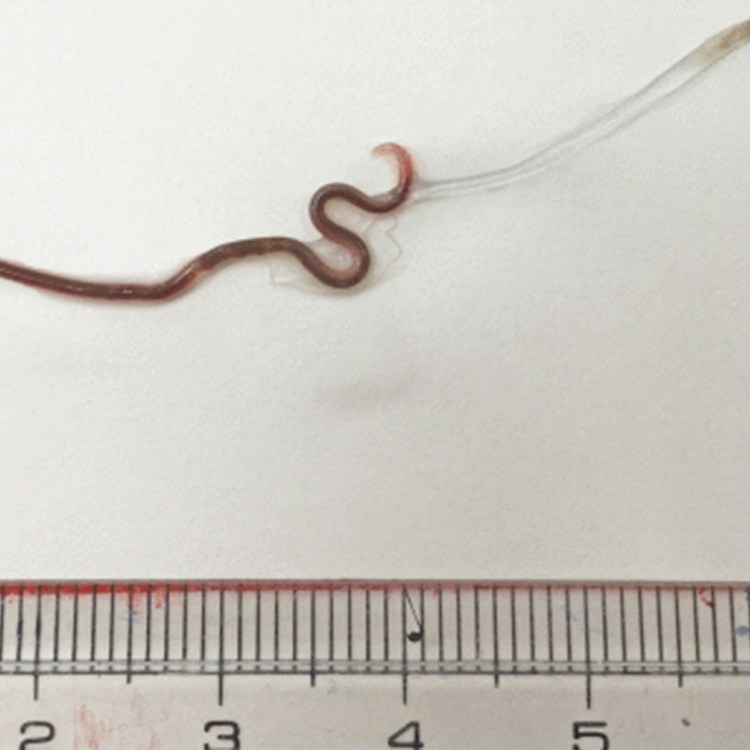 Червь нематода Земляной
