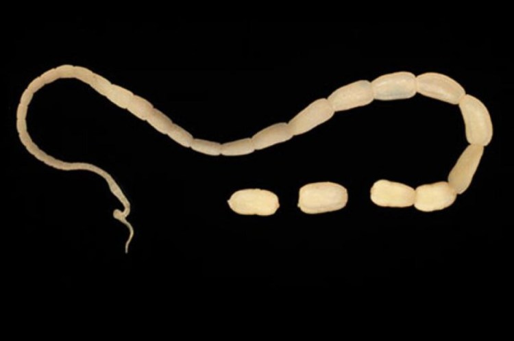 Острицы лямблии аскариды