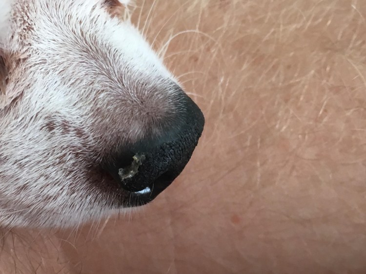 Малассезиозный дерматит