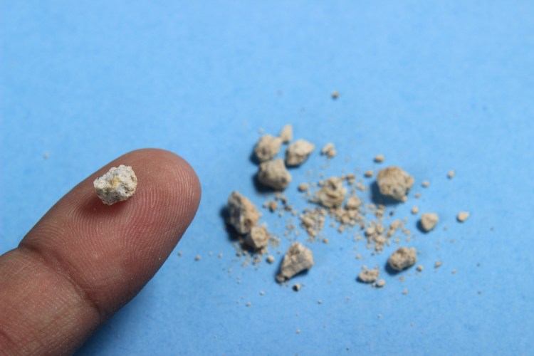 Фосфаты микроскопия мочи