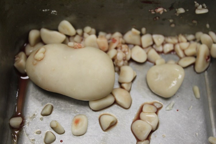 Мочекаменные болезни уратные камни