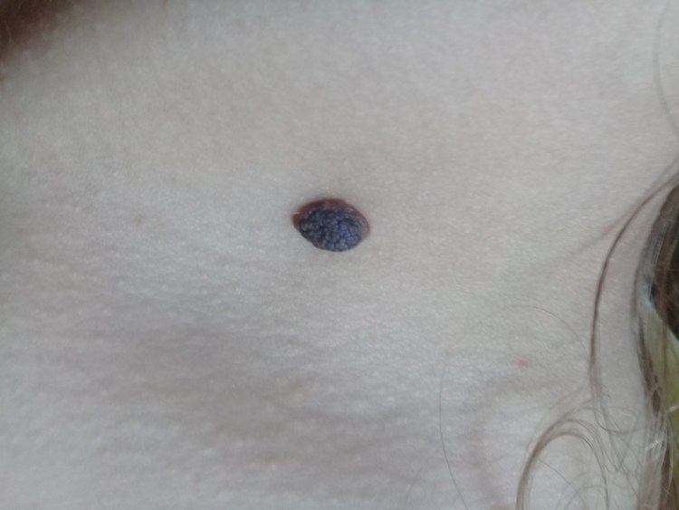 Кот с бабочкой на носу