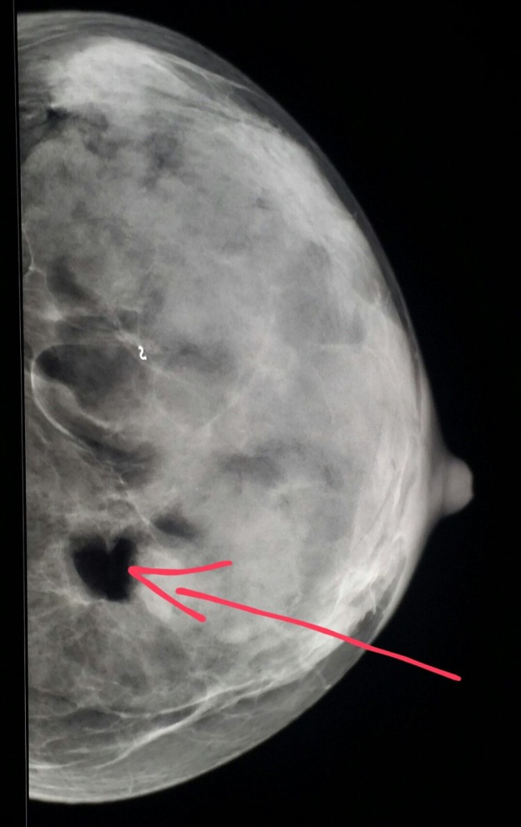 Новообразования у кошек