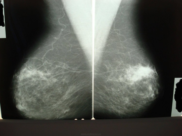 Кот обморозил лапы и орет