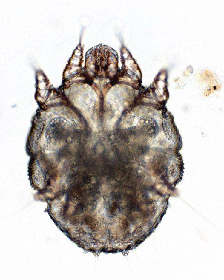 Чесоточный клещ под микроскопом