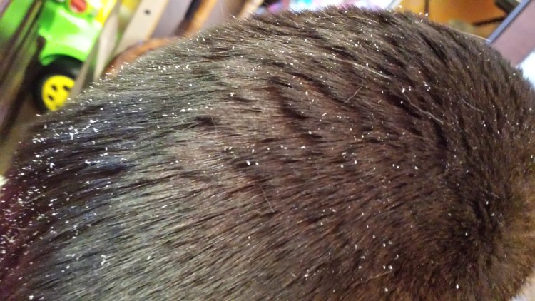 Выпадение шерсти у кошки