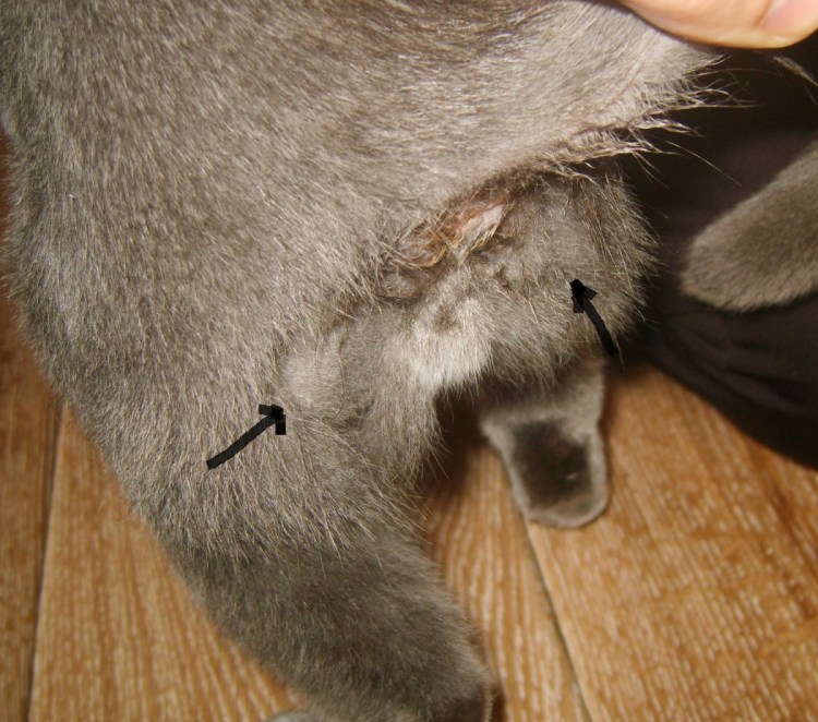 Воспаление перепнпльных желез