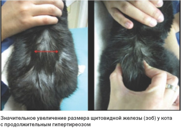 Параанальный синусит абсцесс