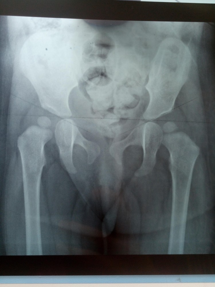 Дисплазия тазобедренных суставов у собак