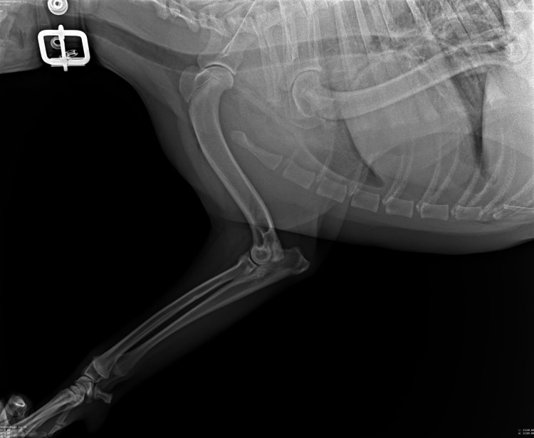 Краниодиафизарная дисплазия