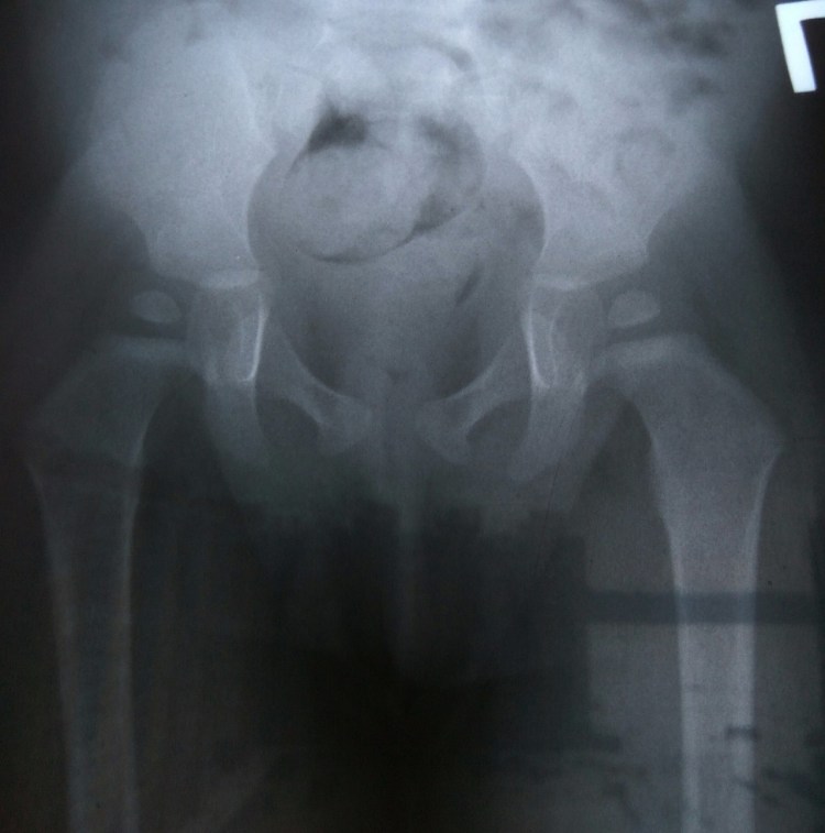 Дисплазия суставов у алабаев