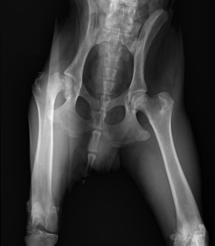 Дисплазия тазобедренных суставов мкб код 10