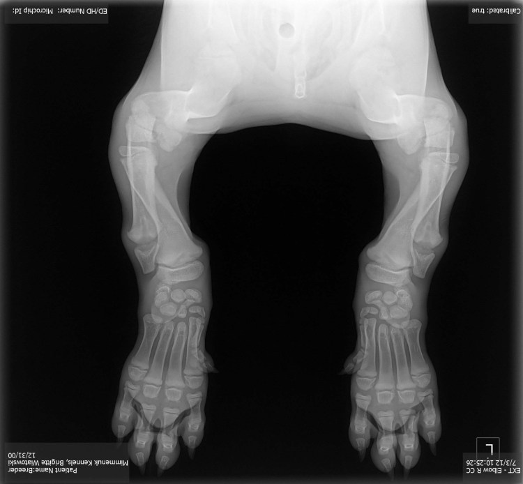 Дисплазия тазобедренных суставов мкб 10