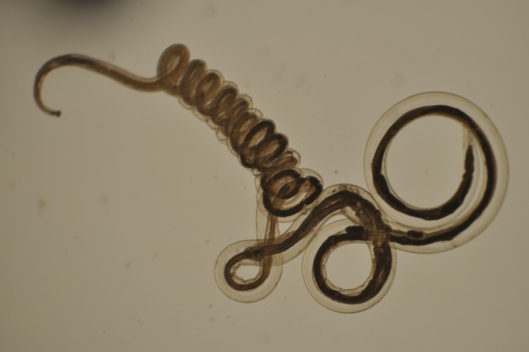 Острицы в Кале микроскопия