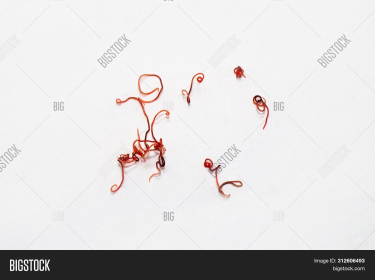 Токсокароз возбудитель Toxocara canis