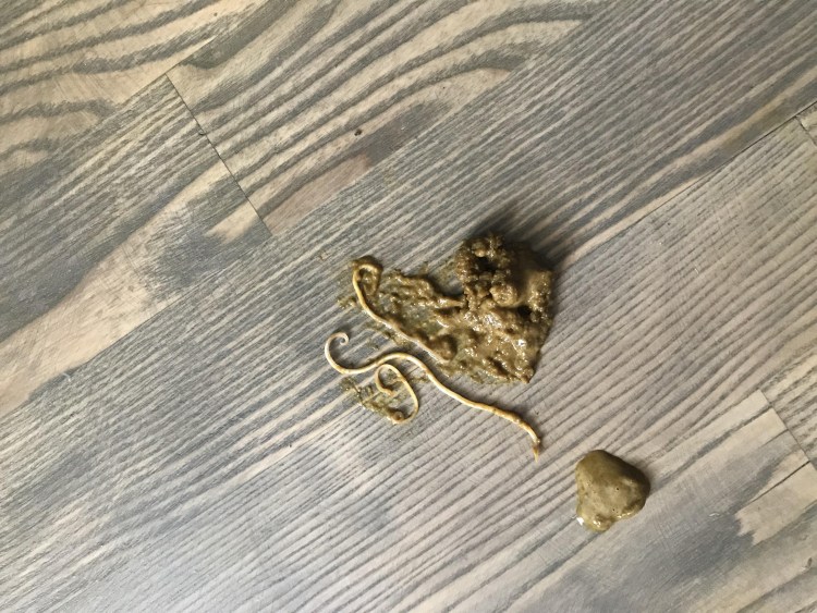 Как выглядит клостридия в Кале