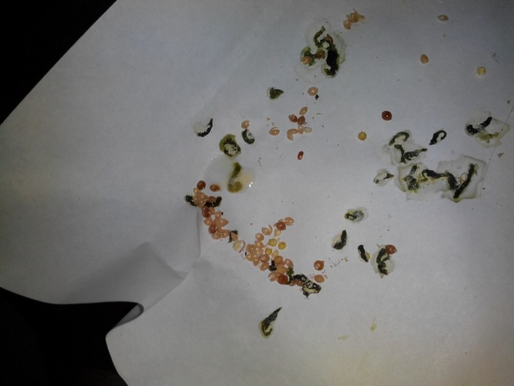 Яйца гельминтов микроскопия