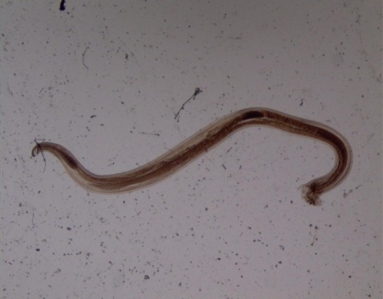 Личинки лямблии в Кале