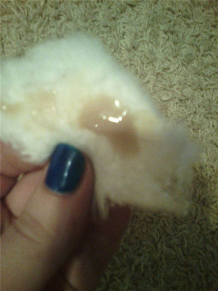 Светло бежевые выделения