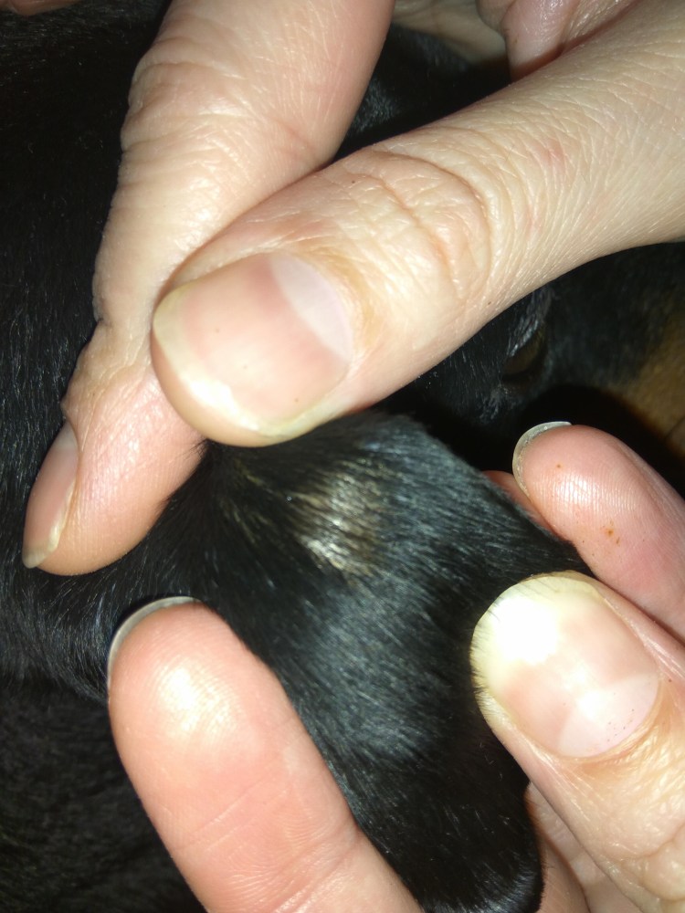 Малассезиозный дерматит