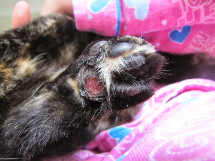 Босерон прибылые пальцы