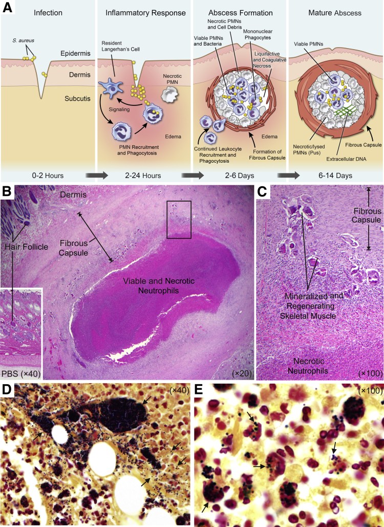 Бактериофаг стафилококковый золотистый