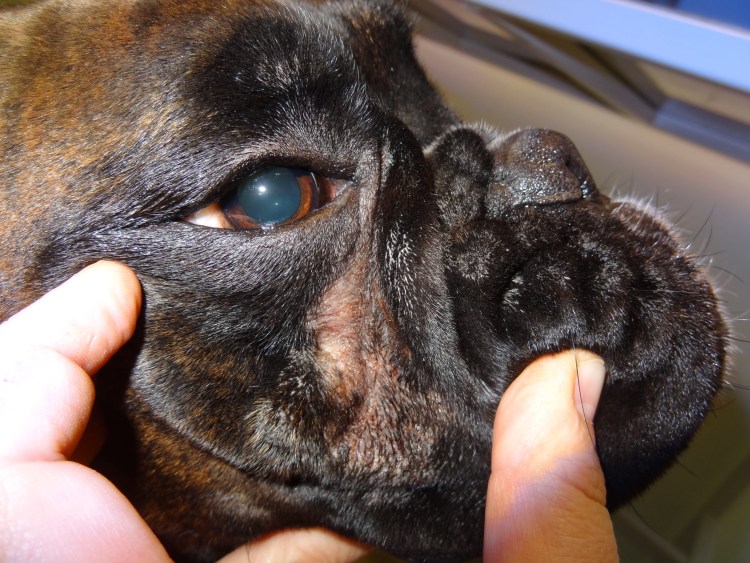 Стрептококкового интертриго