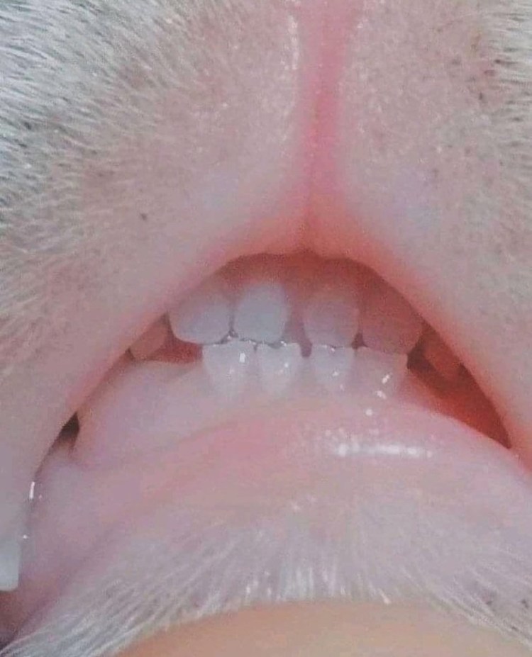 Котёнок показывапет зубы