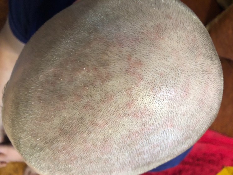 Морщинистый канадский сфинкс