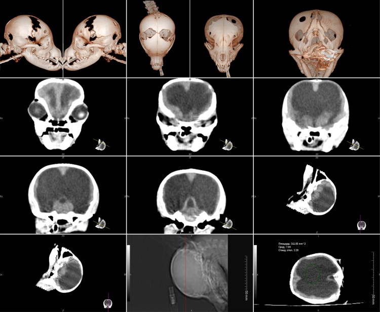 Чихуахуа мини пучеглазые