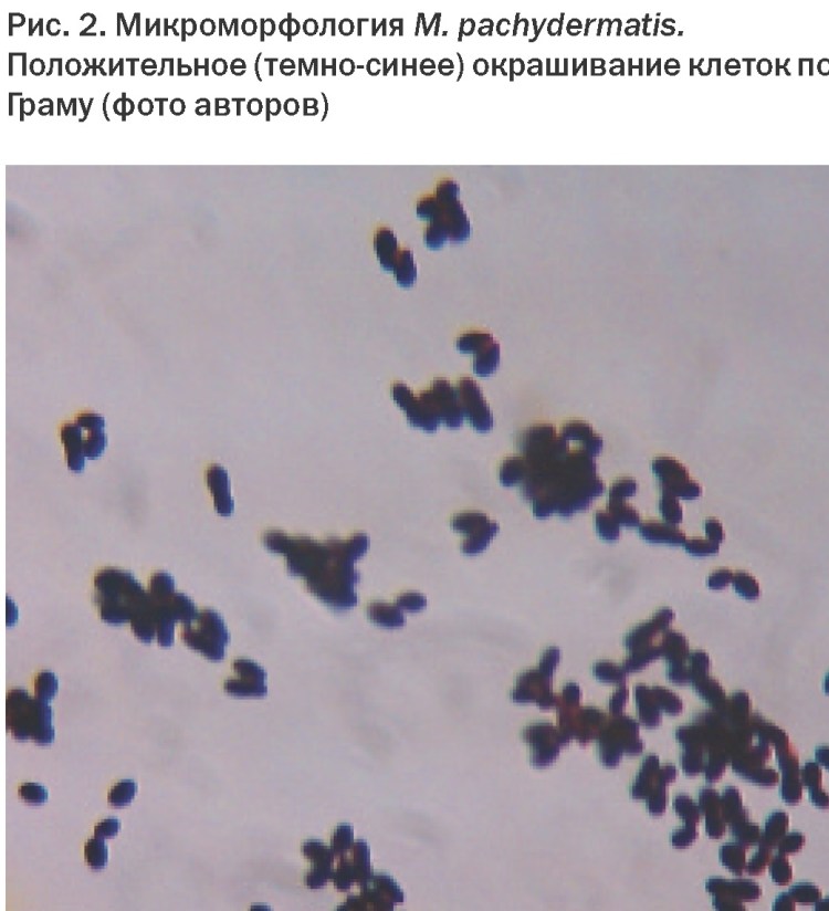 Малассезия под микроскопом