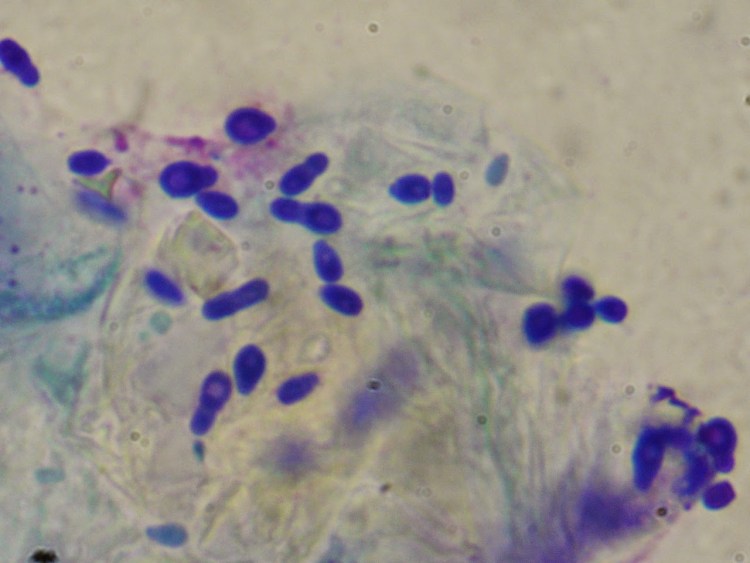 Малассезия микроскопия