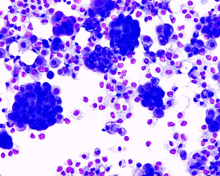 Малассезия под микроскопом у человека в гинекологии